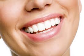 TEETH WHITENING Harrow